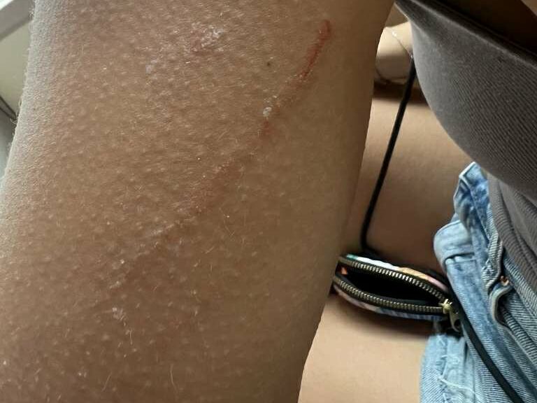 griffure de singes au parc national de penang malaisie